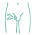 Femoral Hernia (Outer Groin)